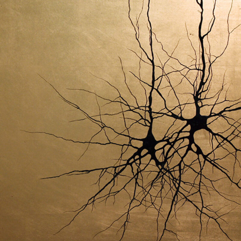 La Plasticidad Cerebral